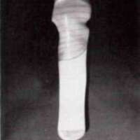 http://www.oandplibrary.org/al/images/1971_01_022/1971_01_022-07.jpg