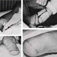 http://www.oandplibrary.org/al/images/1969_01_001/spring69-12.jpg