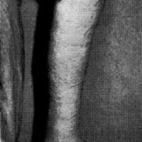 http://www.oandplibrary.org/al/images/1967_02_028/aut67-11.jpg