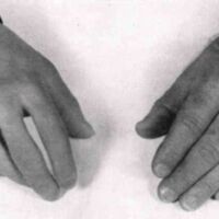 http://www.oandplibrary.org/al/images/1955_02_047/1955-MayOCRBatch-37.jpg