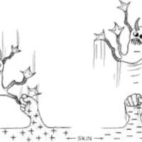 http://www.oandplibrary.org/al/images/1956_01_004/spring56-08.jpg