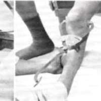 http://www.oandplibrary.org/al/images/1966_02_005/aut66-2-02.jpg