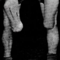 http://www.oandplibrary.org/al/images/1967_01_001/1967_01_001-04.jpg