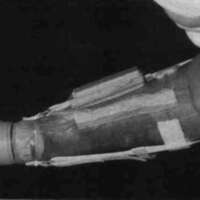 http://www.oandplibrary.org/cpo/images/1987_01_045/1987_01-045-02.jpg