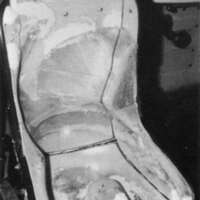http://www.oandplibrary.org/cpo/images/1987_01_049/1987_01_049-07.jpg