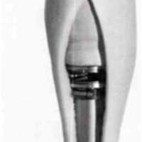 http://www.oandplibrary.org/al/images/1970_02_001/tmp627-12.jpg