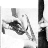 http://www.oandplibrary.org/al/images/1966_02_005/aut66-2-15.jpg