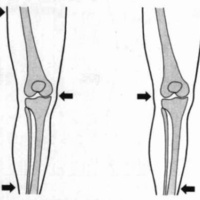 http://www.oandplibrary.org/cpo/images/1984_02_004/1984_02_004-01.jpg
