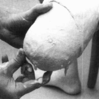http://www.oandplibrary.org/cpo/images/1987_03_118/1987_03_118-04.jpg