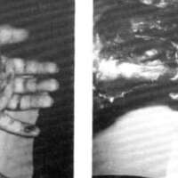 http://www.oandplibrary.org/al/images/1968_01_017/spring68c-01.jpg