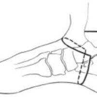 http://www.oandplibrary.org/al/images/1961_01_004/a010.jpg