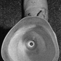 http://www.oandplibrary.org/cpo/images/1986_02_093/1986_02_093-9.jpg