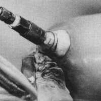 http://www.oandplibrary.org/cpo/images/1987_02_101/1987_02_101-3.jpg