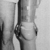 http://www.oandplibrary.org/cpo/images/1987_03_173/1987_03_173-2.jpg