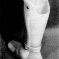 http://www.oandplibrary.org/cpo/images/1977_03_005/1977_03_005-6.jpg