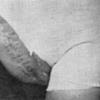 http://www.oandplibrary.org/al/images/1970_01_001/1970_01_001-14.jpg