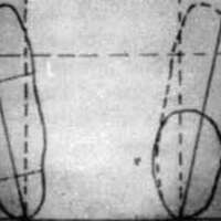 http://www.oandplibrary.org/cpo/images/1977_03_005/1977_03_005-3.jpg