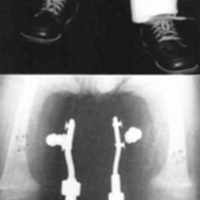 http://www.oandplibrary.org/cpo/images/1985_02_003/1985_02_003-06.jpg