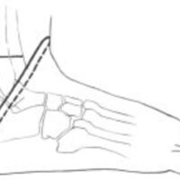 http://www.oandplibrary.org/al/images/1961_01_004/a015.jpg