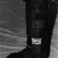 http://www.oandplibrary.org/cpo/images/1988_02_074/1988_02_074-2.jpg