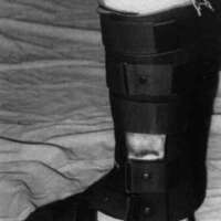 http://www.oandplibrary.org/cpo/images/1988_02_074/1988_02_074-1.jpg