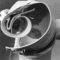 http://www.oandplibrary.org/cpo/images/1988_03_119/1988_03_119-4.jpg