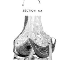 http://www.oandplibrary.org/al/images/1962_02_004/tmp623-15.jpg