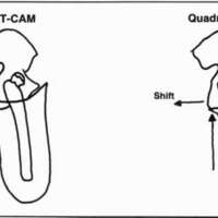 http://www.oandplibrary.org/cpo/images/1985_04_015/1985_04_015-07.jpg