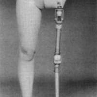 http://www.oandplibrary.org/cpo/images/1988_03_099/1988_03_099-1.jpg