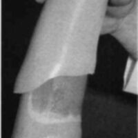 http://www.oandplibrary.org/cpo/images/1985_04_031/1985_04_031-06.jpg