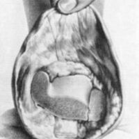 http://www.oandplibrary.org/al/images/1961_01_004/a004.jpg