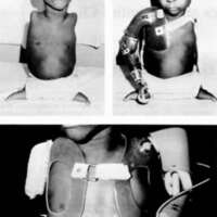 http://www.oandplibrary.org/cpo/images/1978_03_001/1978_03_001-1.jpg