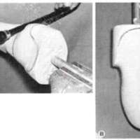 http://www.oandplibrary.org/al/images/1965_01_004/tmp1F18-7.jpg