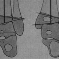 http://www.oandplibrary.org/cpo/images/1986_01_008/1986_01_008-04.jpg