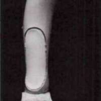 http://www.oandplibrary.org/al/images/1971_01_022/1971_01_022-08.jpg