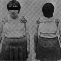 http://www.oandplibrary.org/cpo/images/1979_01_004/1979_01_004-2.jpg