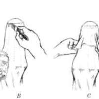 http://www.oandplibrary.org/al/images/1962_02_025/tmp62D-15.jpg