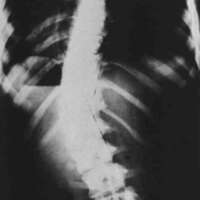http://www.oandplibrary.org/cpo/images/1981_01_001/1981_01_001-6.jpg