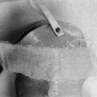 http://www.oandplibrary.org/cpo/images/1986_03_119/1986_03_119-4.jpg