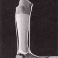 http://www.oandplibrary.org/al/images/1971_01_022/1971_01_022-05.jpg