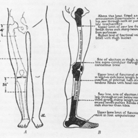 http://www.oandplibrary.org/al/images/1954_03_004/fig2.jpg