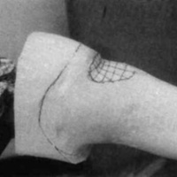 http://www.oandplibrary.org/cpo/images/1987_03_118/1987_03_118-07.jpg