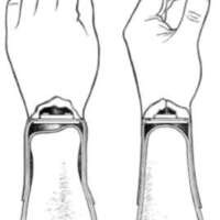 http://www.oandplibrary.org/al/images/1954_03_004/tmp1C6-08.jpg
