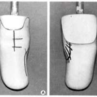 http://www.oandplibrary.org/al/images/1965_01_004/tmp1F18-8.jpg
