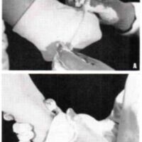 http://www.oandplibrary.org/al/images/1965_02_004/autum65-18.jpg