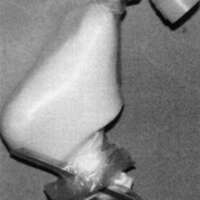 http://www.oandplibrary.org/cpo/images/1988_01_019/1988_01_019-04.jpg