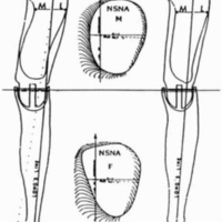 http://www.oandplibrary.org/cpo/images/1988_02_081/1988_02_081-09.jpg