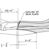 http://www.oandplibrary.org/al/images/1969_01_001/spring69-09.jpg