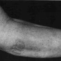 http://www.oandplibrary.org/cpo/images/1987_01_045/1987_01-045-03.jpg