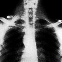 http://www.oandplibrary.org/al/images/1967_02_005/aut67-05.jpg